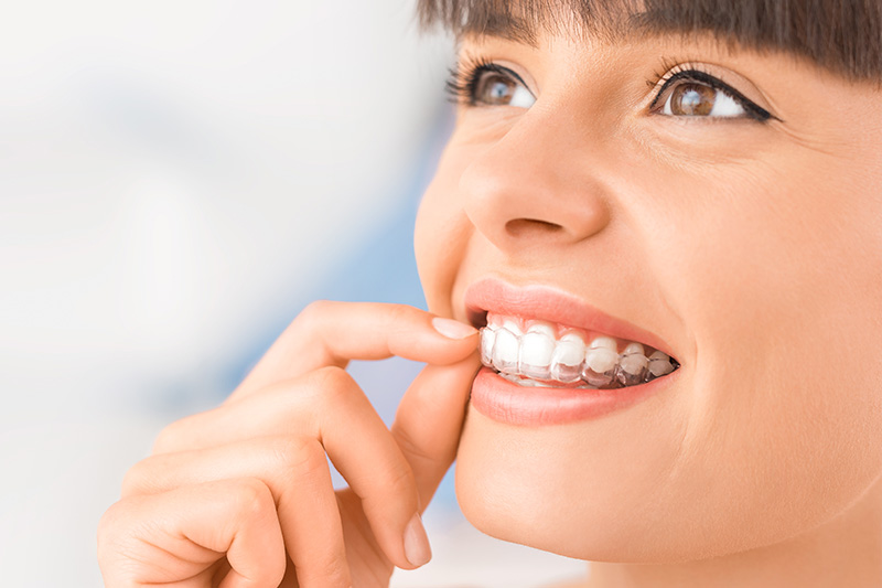 Invisalign in Waxhaw